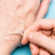 Dry peeling skin: 7 home remedies you can try